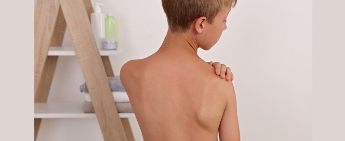 Método Schroth-ISST: Exercícios Específicos para Escoliose