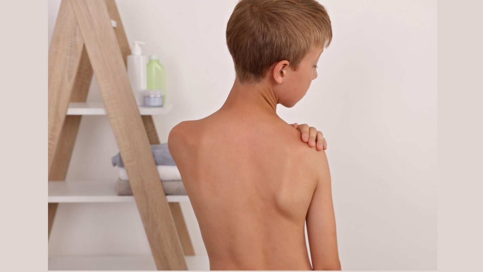 Método Schroth-ISST: Exercícios Específicos para Escoliose